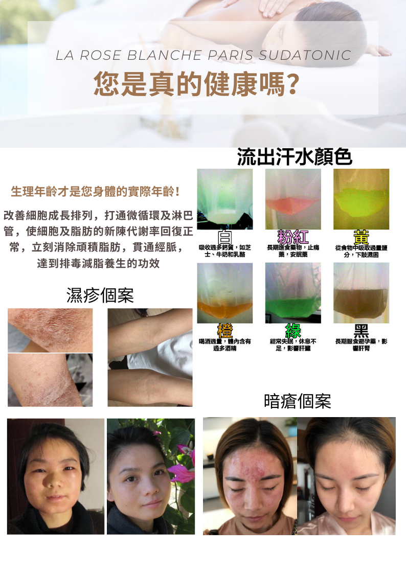 French Sudatonic Eczema Hormone Therapy