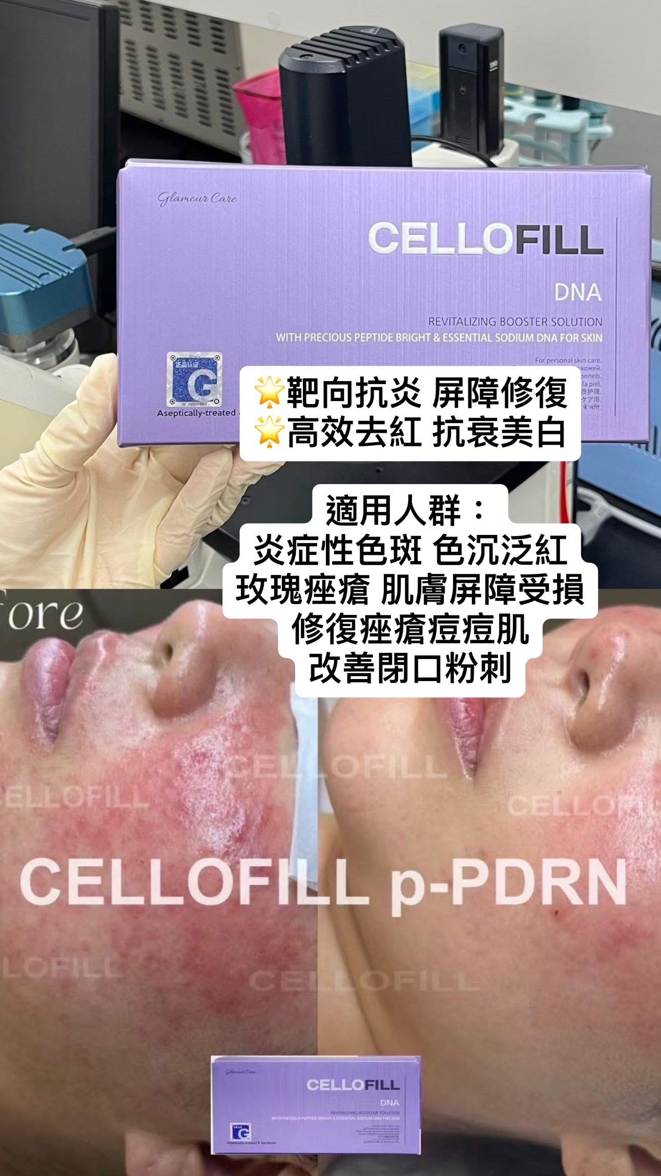 Cellofill DNA Hormone Inflammation Korean Theatrical Version