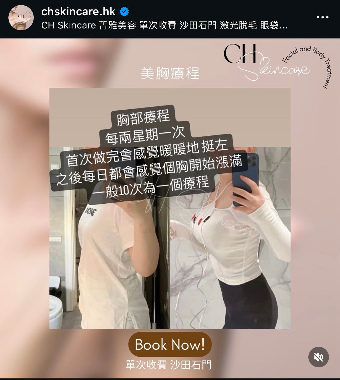 Chinese herbal breast enhancement treatment
